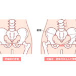 産後ケアに骨盤矯正！